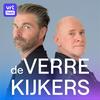 undefined De verrekijkers