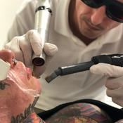 Podcast Eliminación de Tatuajes en Clínica Tufet Barcelona con @queteloquiteluis2.0