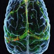 NPP BrainPod