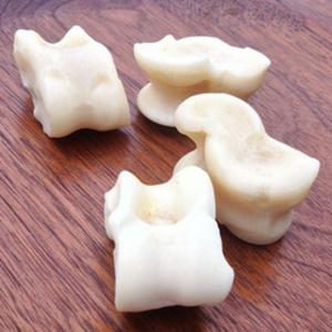 De La Taba al Astrágalo con La Clínica Cemtro